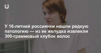 У 16-летней россиянки нашли редкую патологию — из ее желудка извлекли 300-граммовый клубок волос