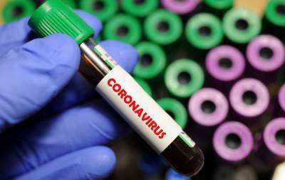 В Грузии выявили первый случай "британского" коронавируса