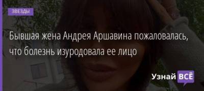 Бывшая жена Андрея Аршавина пожаловалась, что болезнь изуродовала ее лицо