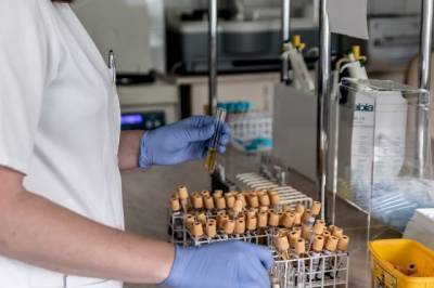 Турецкие ученые научились диагностировать коронавирус за 10 секунд