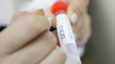 Первых пациентов с "британским" штаммом коронавируса выявили в Словакии