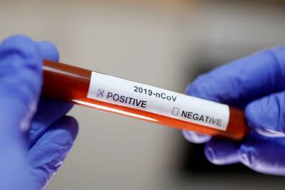 В Ленобласти выявили 216 новых зараженных коронавирусом 5 января