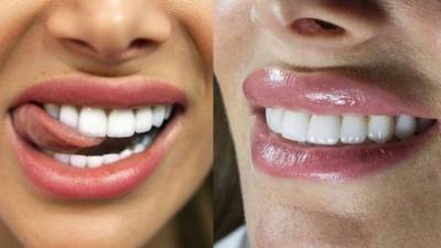 Назван простой способ сохранить цвет зубов