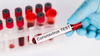Белоруссия получила от России 300 тест-систем для выявления коронавируса