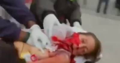 Женщина получила тяжелое ранение в Капитолии