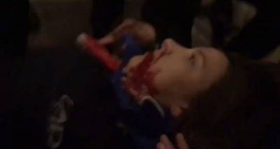 Стрельба в конгрессе США: минимум одна девушка ранена, она в критическом состоянии. Видео