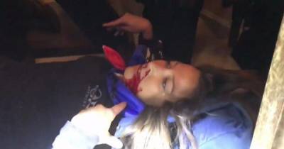 Бунт в США: полиция ранила протестующую, она в критическом состоянии