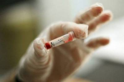Эксперт о вакцинации от COVID-19: ошибки опустили Украину до уровня Африки
