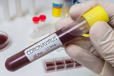 Ещё 242 жителя области подхватили новую коронавирусную инфекцию
