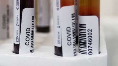 В Удмуртии выявили 260 случаев COVID-19 за сутки