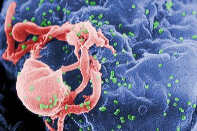 Ученые из США обнаружили способ побороть ВИЧ и мира
