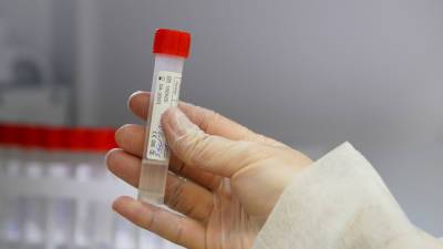 В России за сутки проведено более 580 тысяч тестов на коронавирус