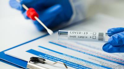 Москвичи смогут сдать бесплатный экспресс-тест на коронавирус в МФЦ и общественных местах