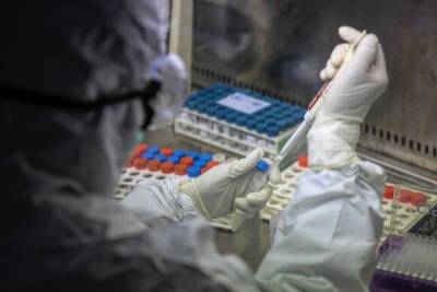 Эксперты оценили вероятность распространения чумы в России