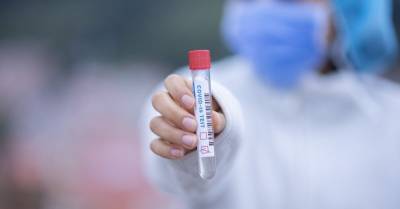 Жителям, которые не могут вакцинироваться от Covid-19, разрешат бесплатно сдавать тесты