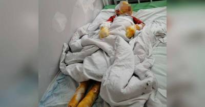 Следственный комитет определит виновных в поджоге ребенка в Крыму