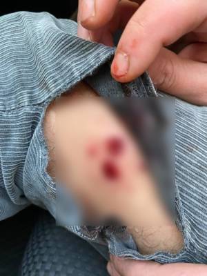 Под Киевом мужчина расстрелял авто с семьей: есть раненый