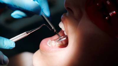 Хирург пояснил, почему россияне избегают походов к стоматологам