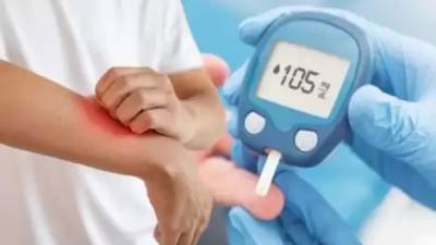 Вчені розповіли про «тихі» ознаки діабету