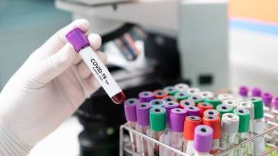 В России за сутки выявили 28 717 новых случаев коронавируса
