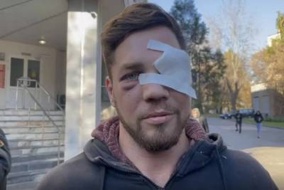 «Думал, что фейк»: избитый в метро москвич оценил шутку Хабиба
