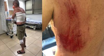 Ужас в Хайфе: дикие кабаны напали на мужчину, он попал в больницу