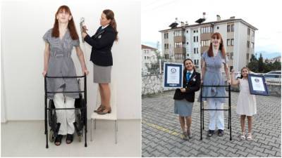 Жительница Турции признана самой высокой в мире женщиной