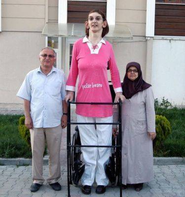 Самая высокая женщина мира живёт в Турции