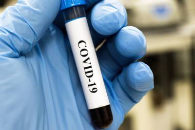 COVID-19 мог появиться как мутация коронавирусов