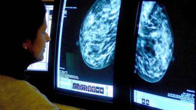 Онколог перечислил признаки повышенного риска рака молочной железы