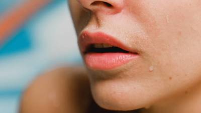 Терапевт Терентьева заявила, что трещины в уголках губ возникают из-за стрептококков и грибков