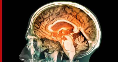 Способы замедлить старение головного мозга назвал врач