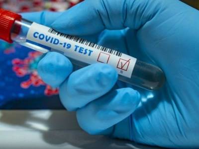 Какие существуют тесты на коронавирус и как правильно пройти обследование на COVID-19