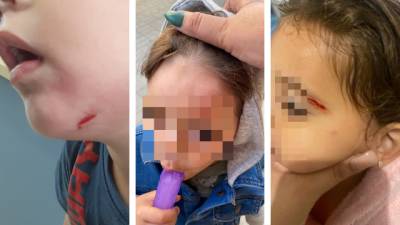 Укусы, ушибы и ссадины: 3-летний мальчик терроризирует детский сад в Ришон ле-Ционе
