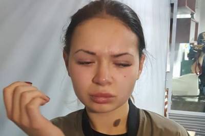 Зайцева выплатила издевательскую компенсацию жертве ДТП: "За 2 месяца лишь..."
