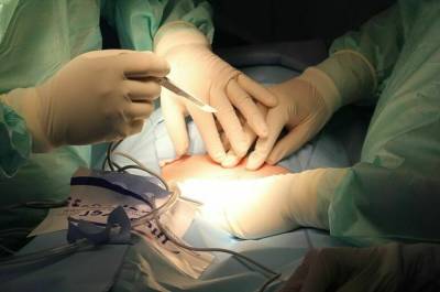 Могут ли в России появиться чёрные трансплантологи?
