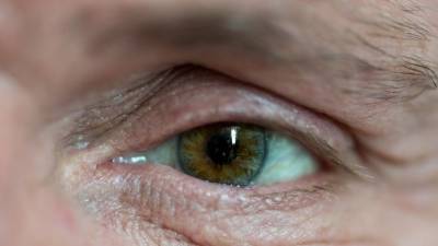 Ученый заявил, что раковую опухоль можно «увидеть» в глазах пациента