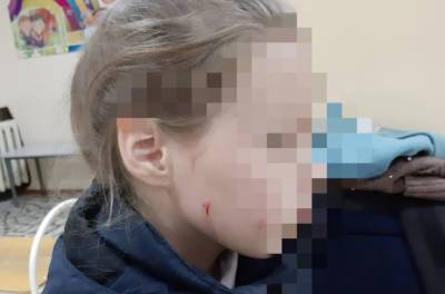 В Уфе неадекватная бабушка ударила головой о стену дома девочку, которая которая подкармливала кошек