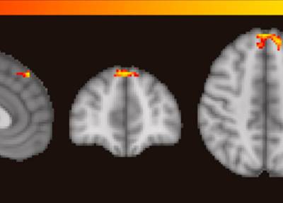 Ученые визуализировали работу мозга при насилии и обмане