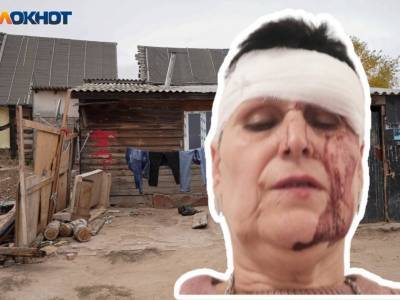 В Волгограде у цыганского гетто русской женщине разбили кирпичом голову