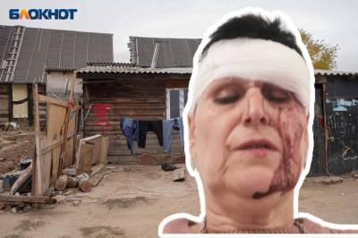 В Волгограде женщине пробили голову за замечание цыганским детям - 7info.ru - Волгоград - Нападение