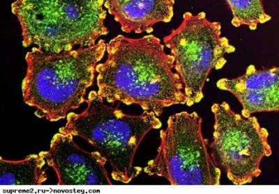 Новый метод позволяет обнаружить раковые клетки еще до появления опухоли