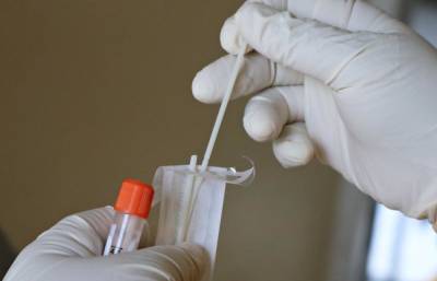 В России предлагают бесплатно тестировать граждан на коронавирус