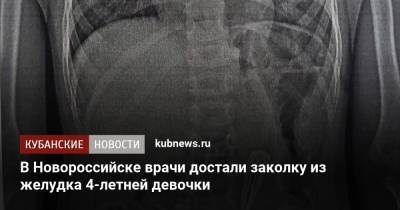В Новороссийске врачи достали заколку из желудка 4-летней девочки
