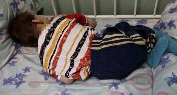 Традиции семейства Блохиных продолжены: в Вологде вновь обнаружен избитый ребенок