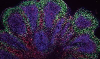 В Кембридже вырастили органоиды мозга, просуществовавшие год