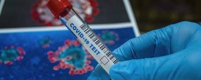 В Новосибирской области за сутки от коронавируса скончались 13 человек