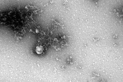 Впервые опубликованы фотографии «дельта»-штамма коронавируса