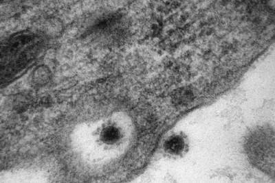 Ученые опубликовали фотографии дельта-штамма Covid-19