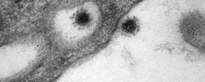 Центр «Вектор» впервые опубликовал фото дельта-штамма SARS-CoV-2, снятое на электронный микроскоп